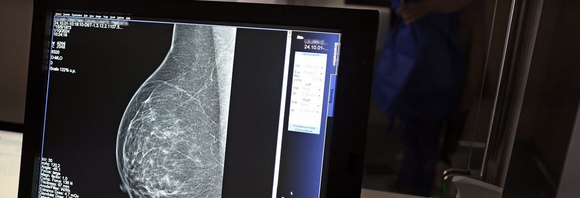 Falta de acesso a mamógrafos limita prevenção do câncer de mama