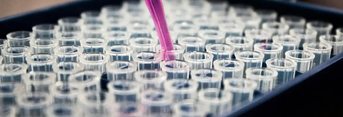 Pesquisas brasileiras avançam no diagnóstico de Alzheimer