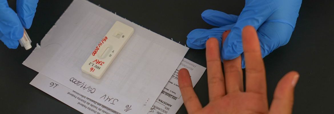 HIV/Aids: Brasil vai insistir em acordo por PrEP de longa duração