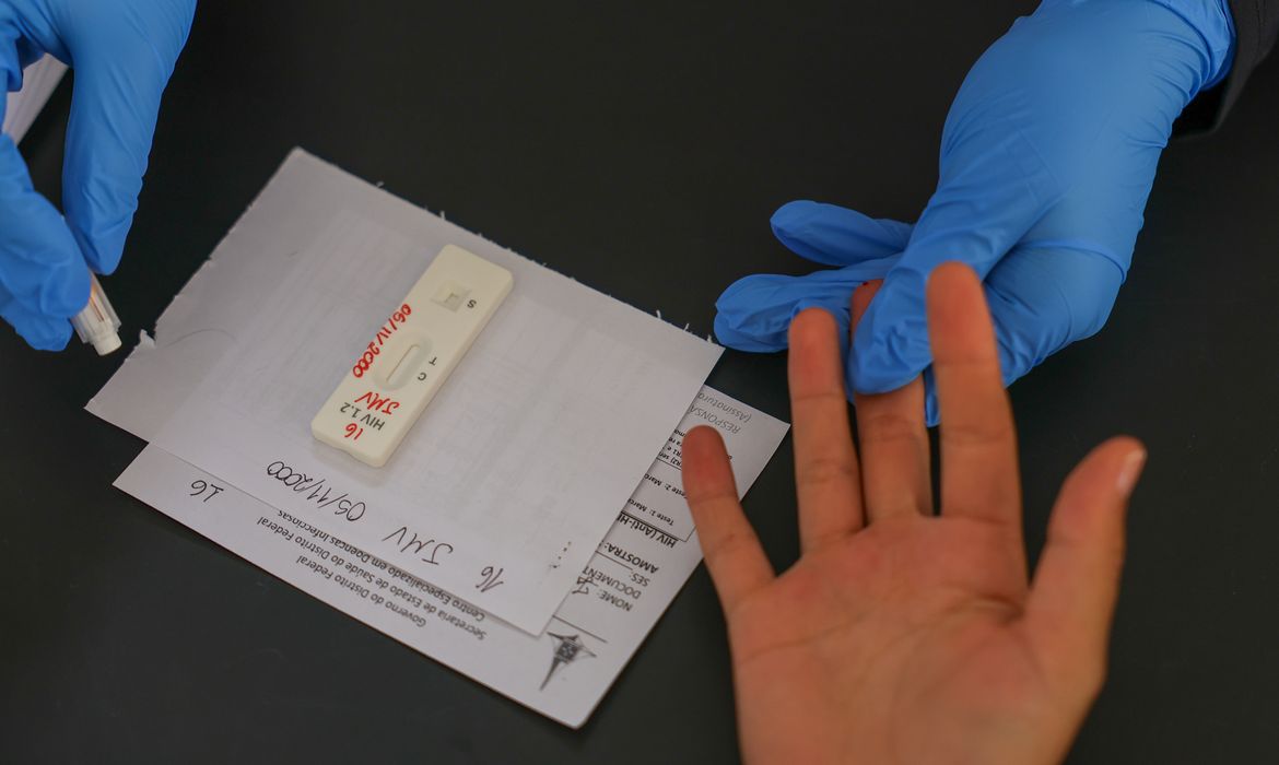 OAB Barro Preto - HIV/Aids: Brasil vai insistir em acordo por PrEP de longa duração