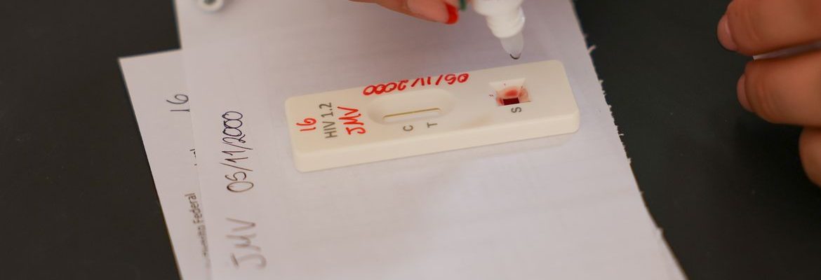 Ação no DF oferece testagem rápida e informação sobre HIV/Aids