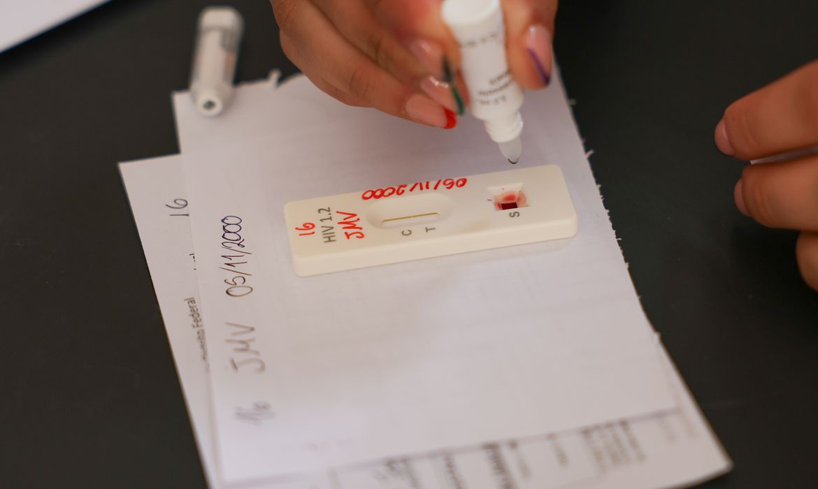 OAB Barro Preto - Ação no DF oferece testagem rápida e informação sobre HIV/Aids