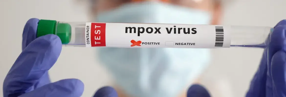 Secretaria de Saúde confirma segundo caso de mpox do grupo lp em SP