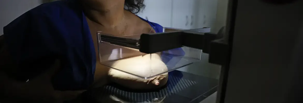 Vigitel: 92% das brasileiras entre 50 e 69 anos fizeram mamografia